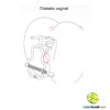 Dilatador vaginal - Imagem 6
