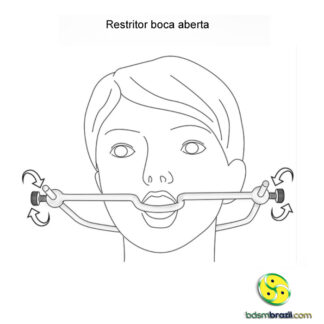 Restritor boca aberta